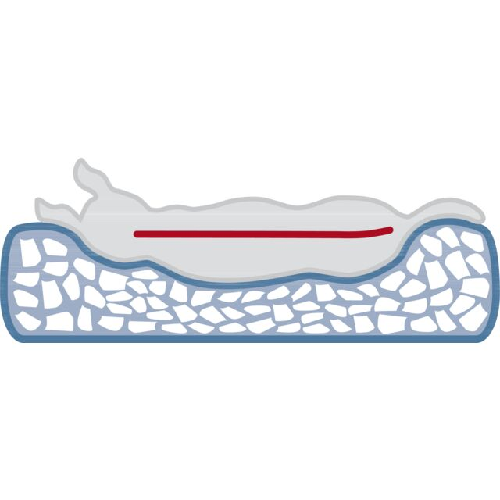 Panier orthopédique chien : mémoire de forme, couchage confortable Loki ROSE