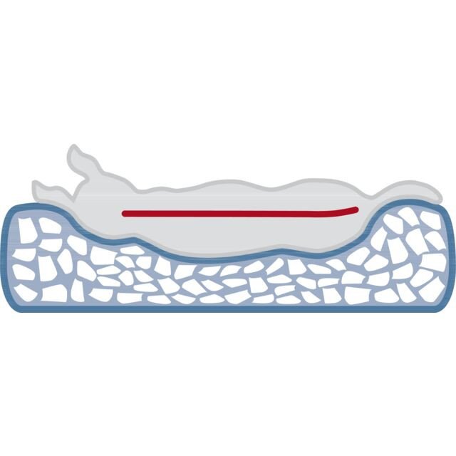 Coussin orthopédique, mémoire de forme, déhoussable Loki